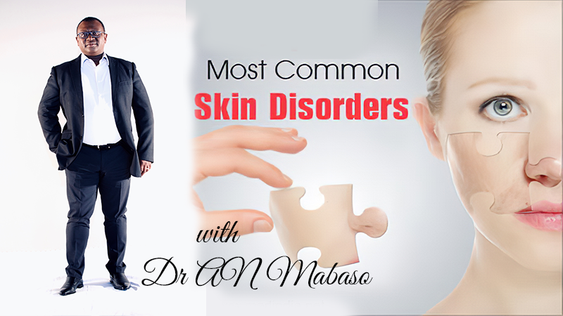 Common skin conditions